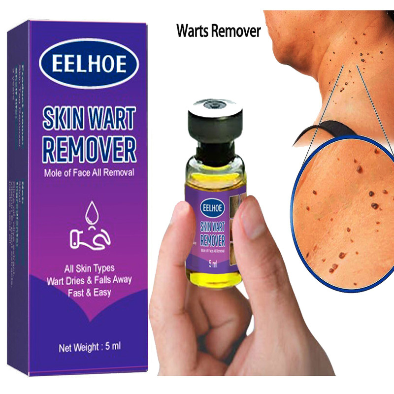 EELHOE SKIN WART REMOVER