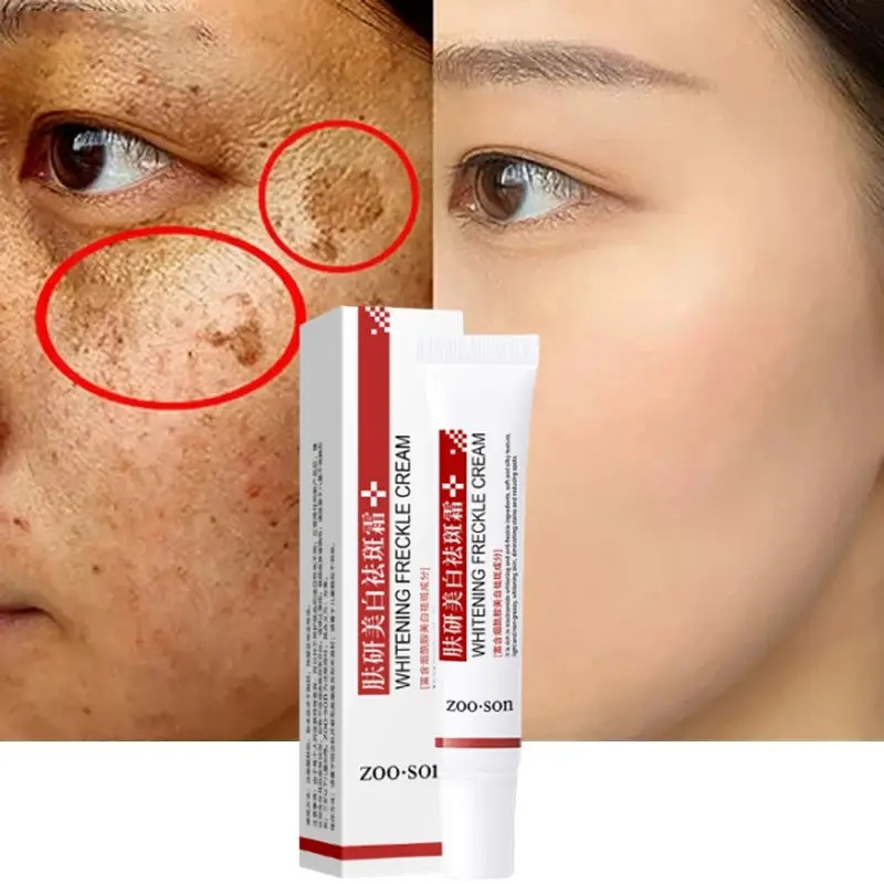 WHITENING FRECKLE CREAM